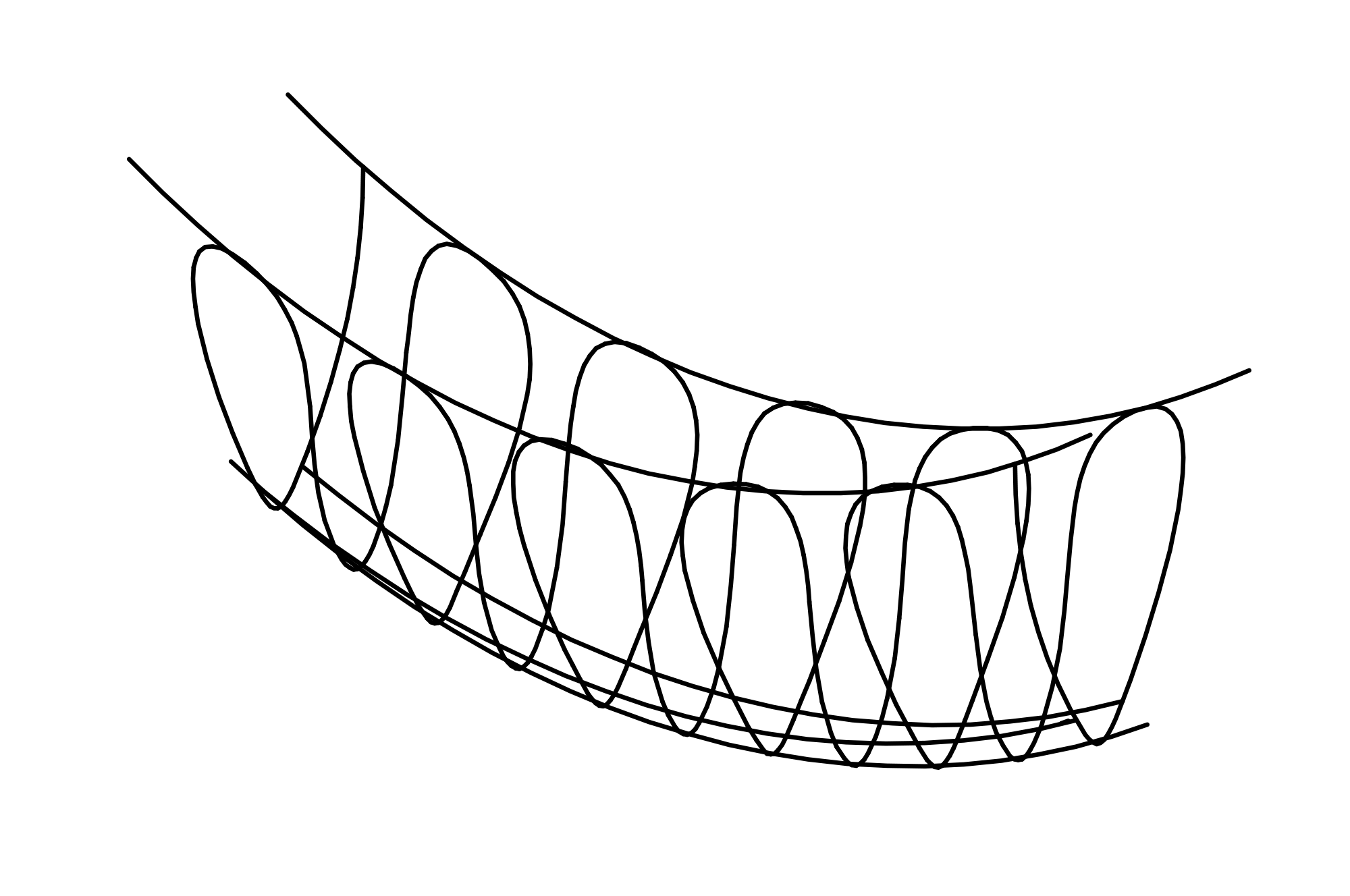 Rope Bridge, red, length = 5 m